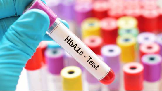 Apa itu tes Glycated Hemoglobin (HbA1c)?