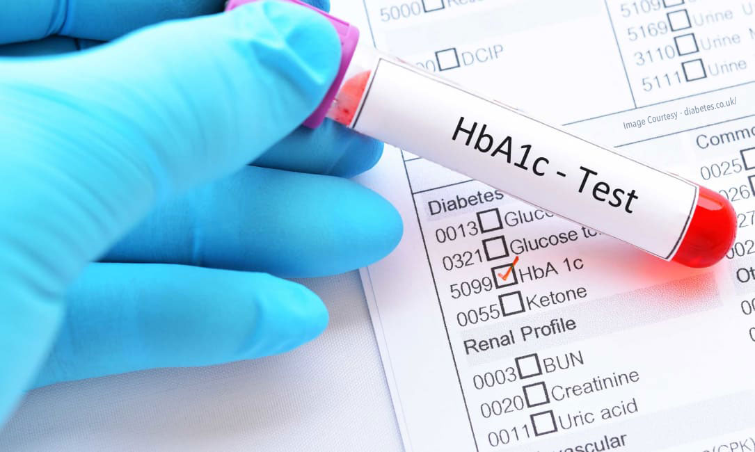 Tes HbA1c untuk populasi yang berbeda